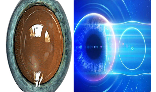 icl.jpg